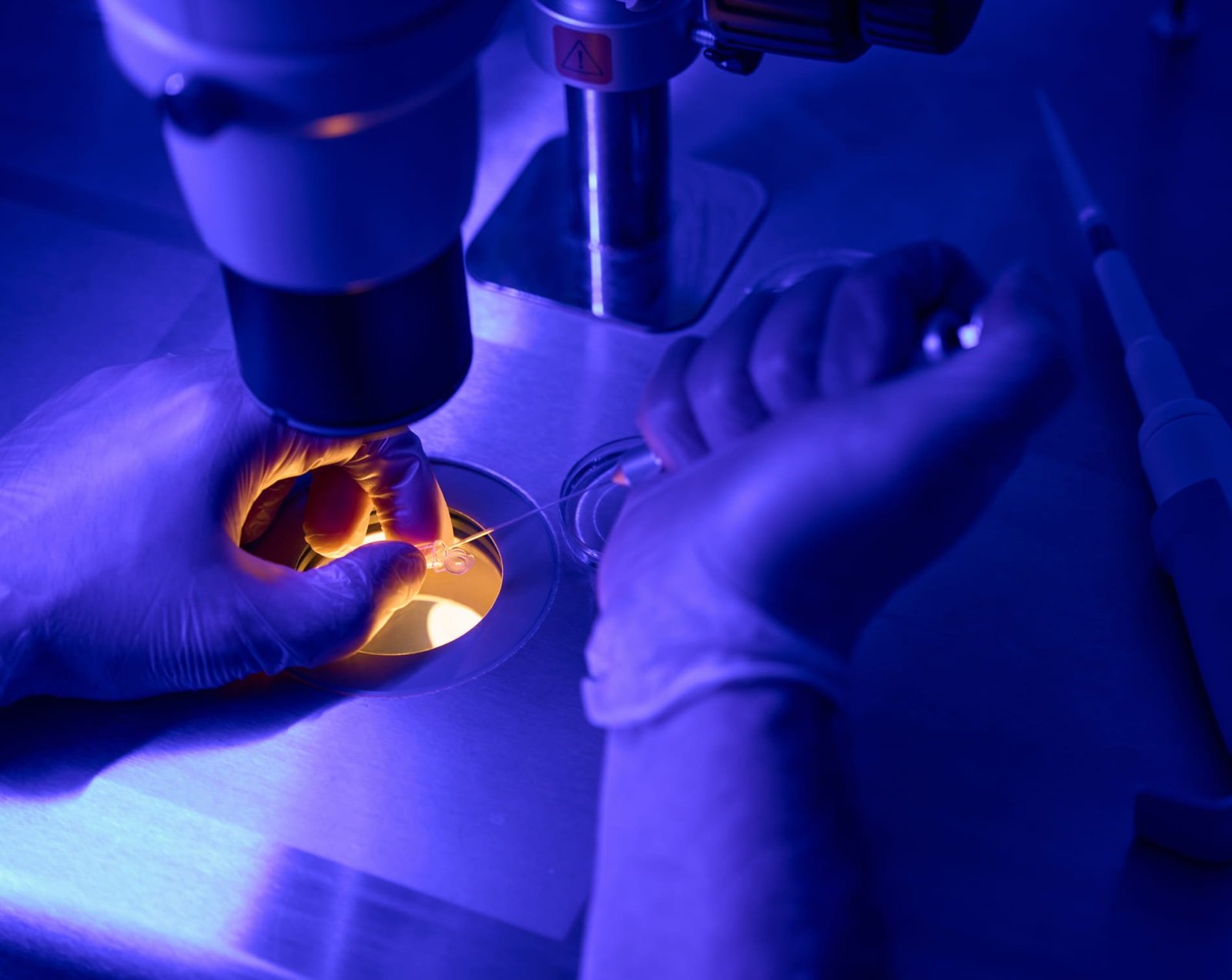 Equipe CGE – Biópsia do Endométrio