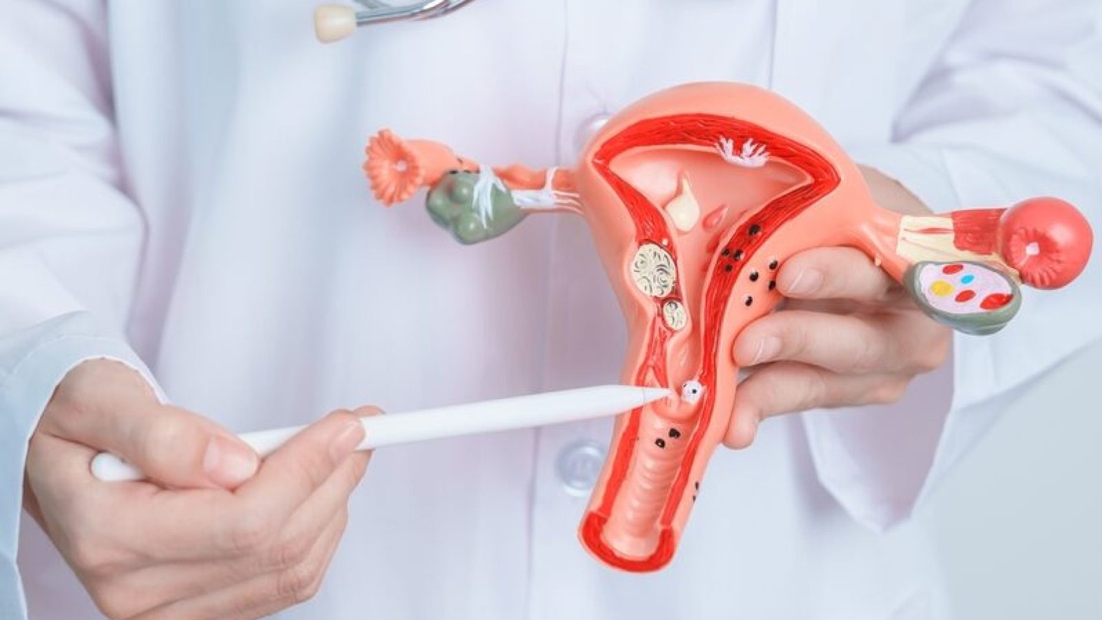 Doctor,Holding,Uterus,And,Ovaries,Model.,Ovarian,And,Cervical,Cancer,